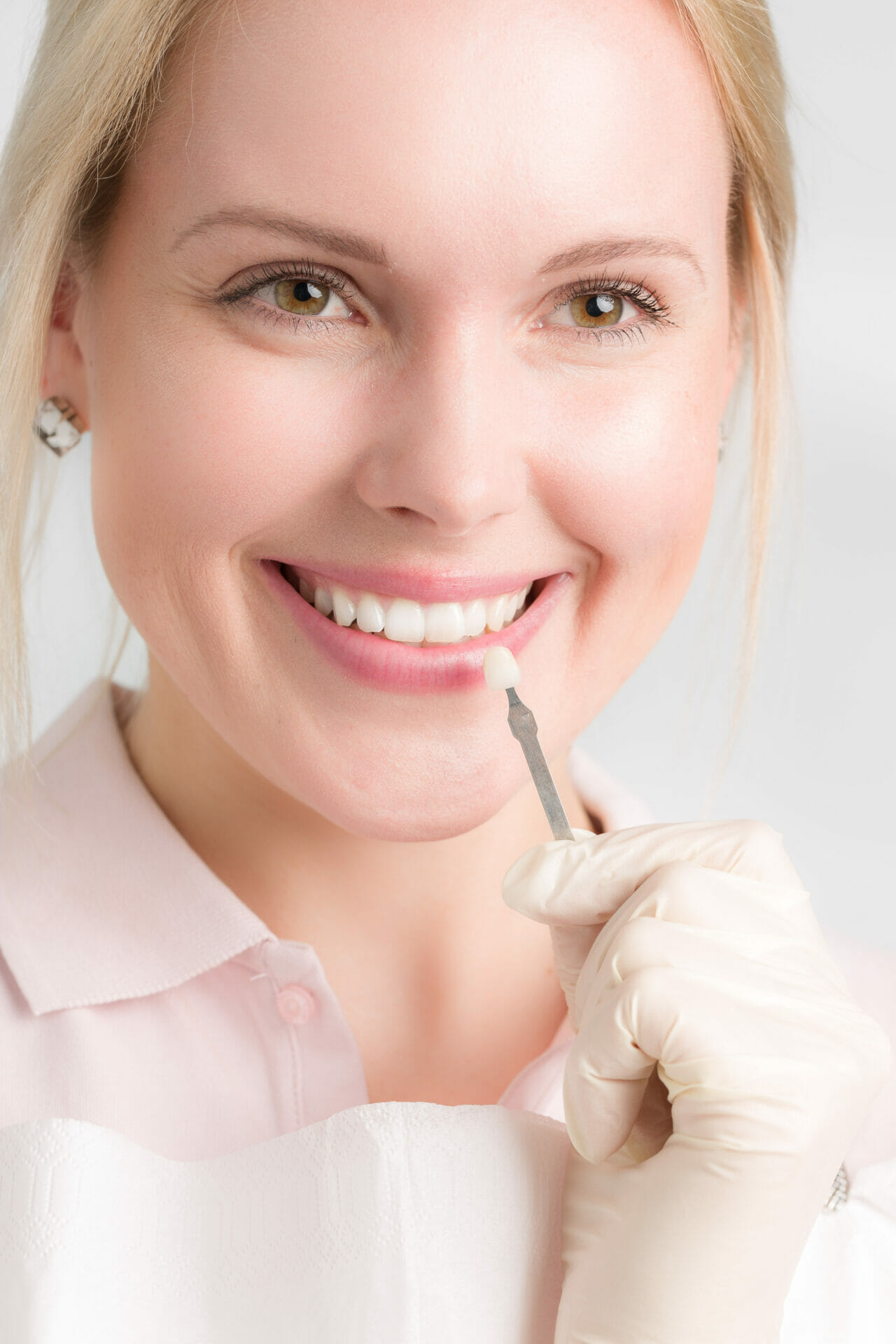 Dental Veneers Palm Beach Dental (Book Now)