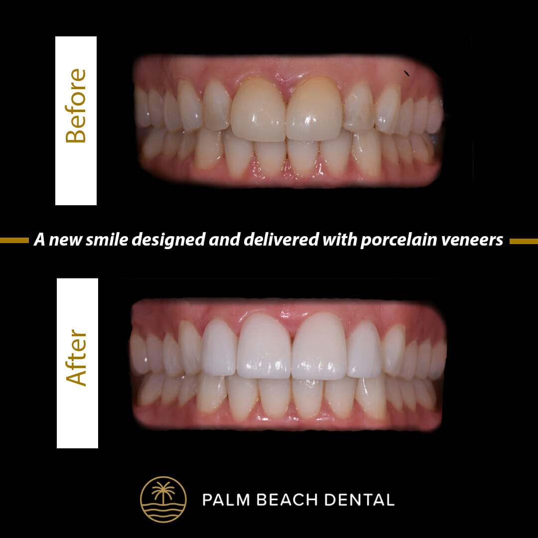 Your All in One Dentist in West Palm Beach | KA Dental Your All in One Dentist in West Palm Beach | KA Dental
