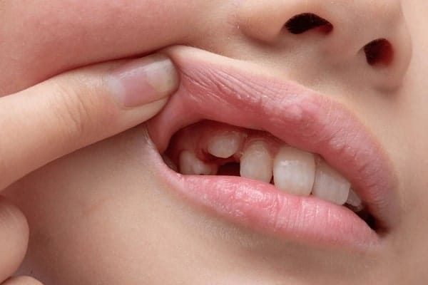 grow teeth naturally